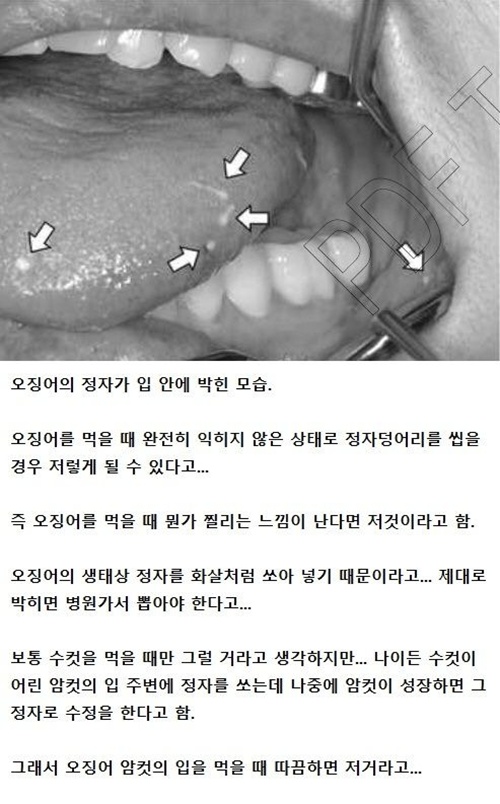 헐.. 저거 뭐야